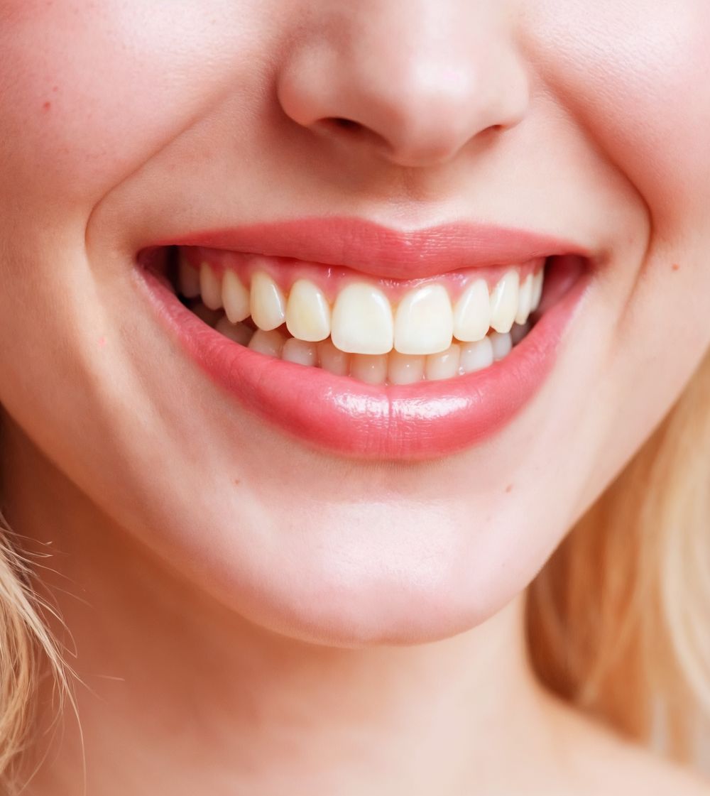 Sonrisa antes del tratamiento